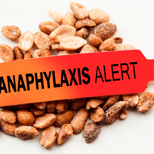 Anaphylaxis attack