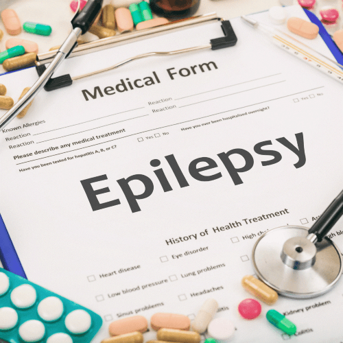 Treatment-of-epilepsy