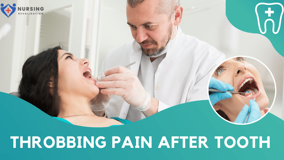 Throbbing Pain After Tooth